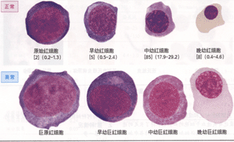 (1)原始红细胞:胞体直径15～20μm,圆形或椭圆形,边缘常有钝角状或瘤