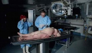 BBC拍片首次揭幕肥胖者“器官”2