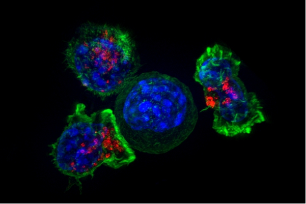 研究人员发现癌细胞的生存机制1