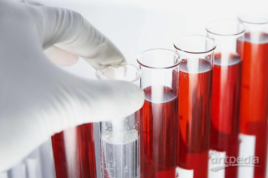 全自动仪器检测中血样本前处理的重要性