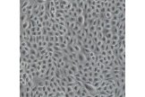 表皮细胞培养