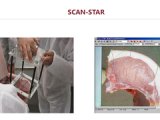 德国MATTHAUS SCAN-STAR肉质眼肌面积分析系统