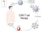 May1_2019_Getty_1137107386_CART-cellTherapy
